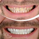 ROC Policlinic Antalya - Before/After 2