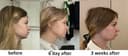 Shinsang Plastic Surgery Clinic - Before/After 2