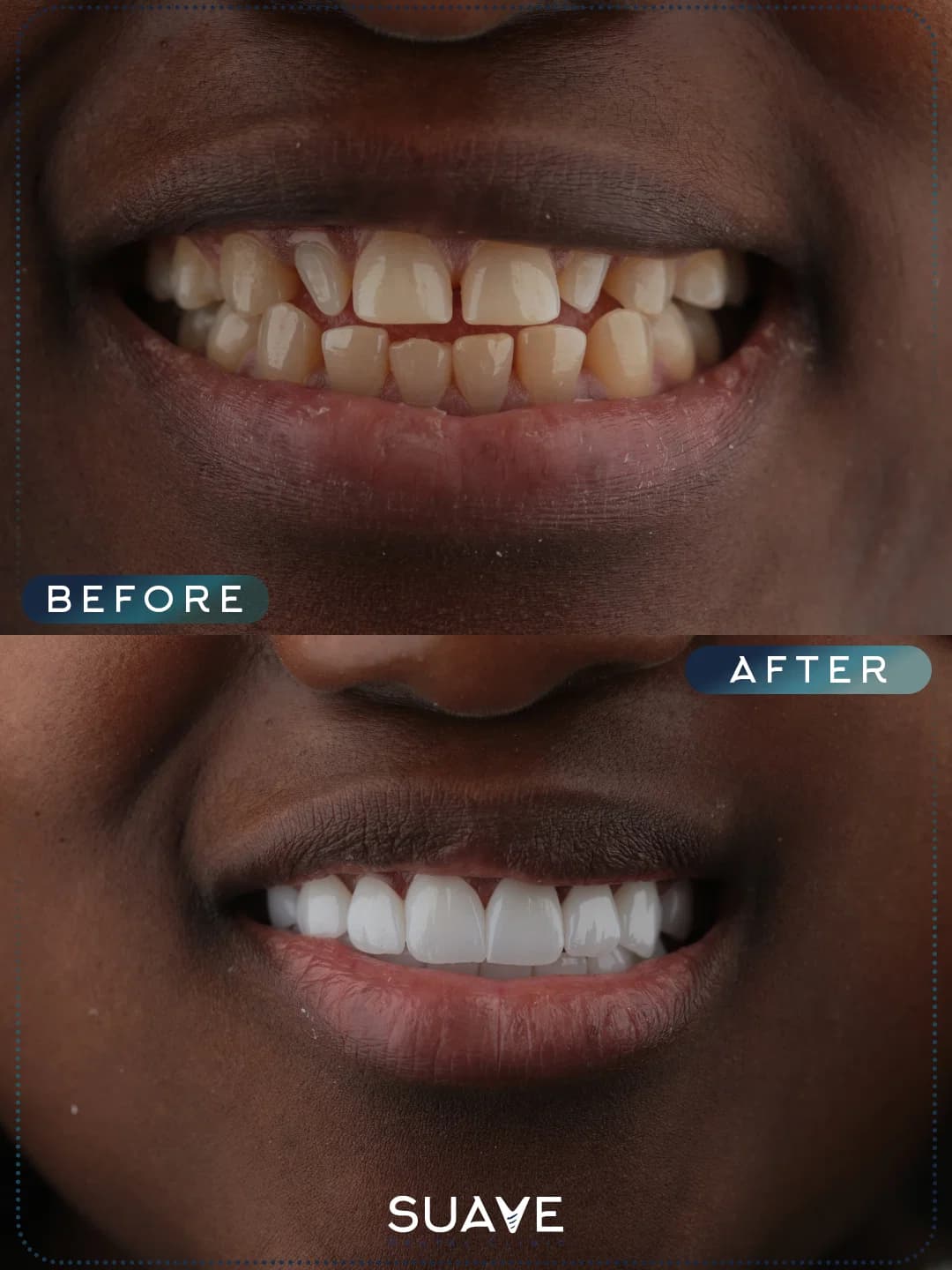 Before/After image 1