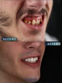 Suave Dental Clinic - Before/After 4