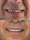 Suave Dental Clinic - Before/After 2