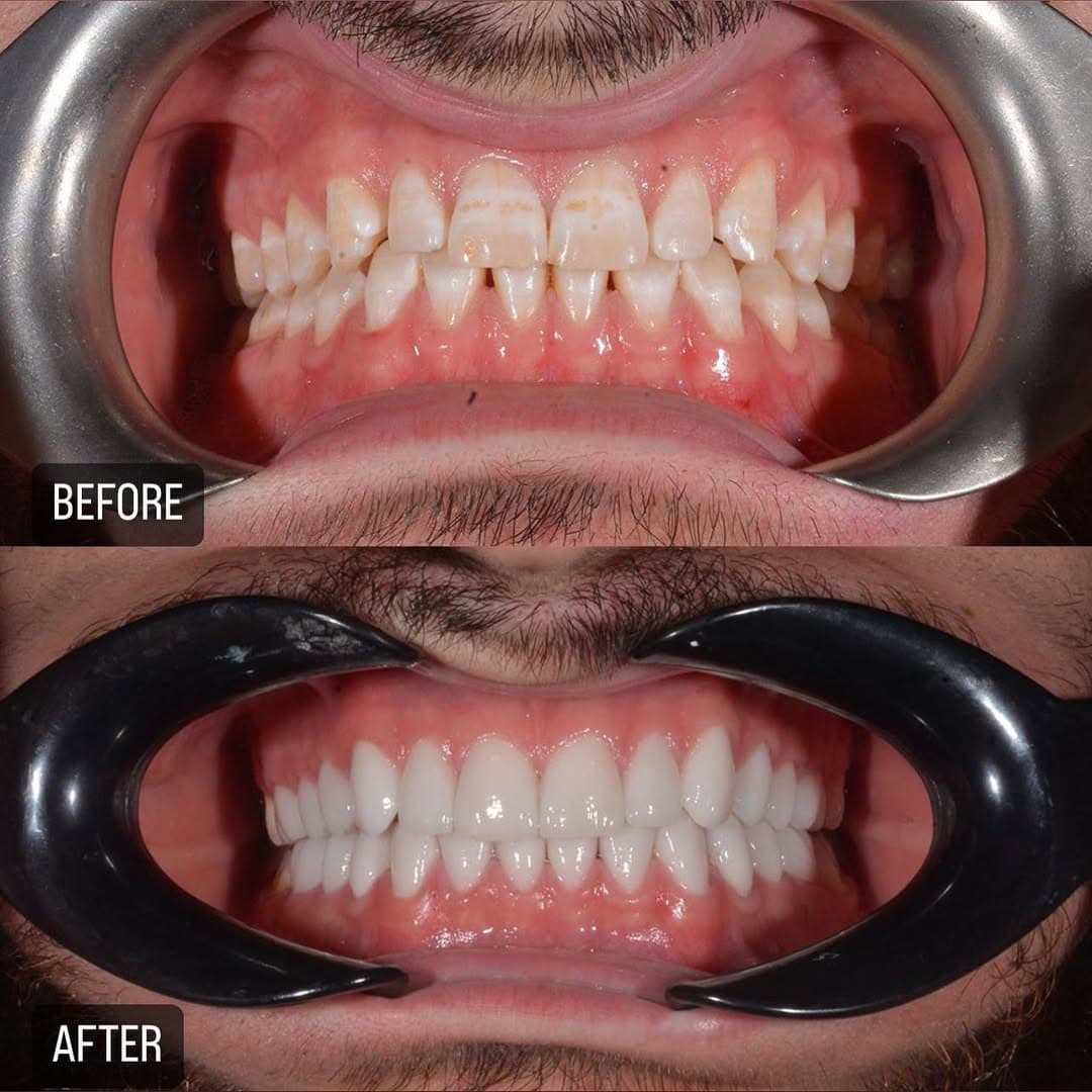 Before/After image 1