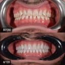 MediArt Dental Clinic Baku - Before/After 1