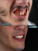 Suave Dental Clinic - Before/After 3