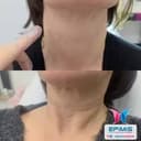 Epimis Estetic Clinic - Before/After 2