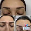 Epimis Estetic Clinic - Before/After 1