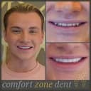 Comfort Zone Dent - Before/After 2