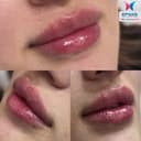 Epimis Estetic Clinic - Before/After 3