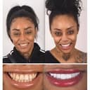 Comfort Zone Dent - Before/After 1