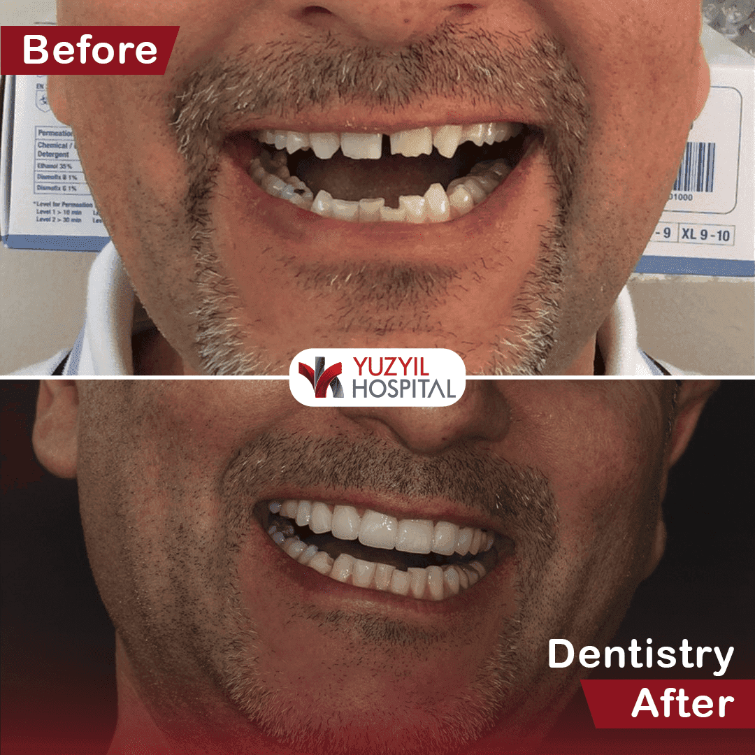 Before/After image 1