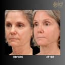 ID Clinic Bangkok - Before/After 4