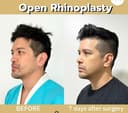 ID Clinic Bangkok - Before/After 3