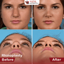 Private Yüzyıl Hospital - Before/After 4