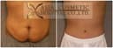 Asia Cosmetic Hospital - Before/After 4
