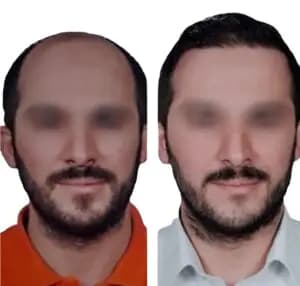 Before/After image 1