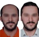 Adem & Havva Medical Center - Before/After 1
