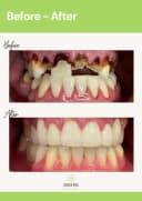 Evergreen Dental - Before/After 2