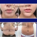 Asia Cosmetic Hospital - Before/After 1