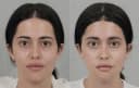 ID Hospital Korea - Before/After 4