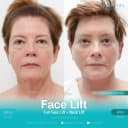 Wansiri Hospital - Before/After 2