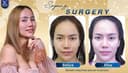 Asia Cosmetic Hospital - Before/After 2