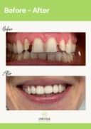 Evergreen Dental - Before/After 4