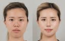 ID Hospital Korea - Before/After 1