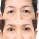 Wansiri Hospital - Before/After 1