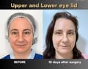 ID Clinic Bangkok - Before/After 2