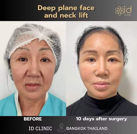 Before/After image 1