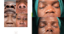 The Nose Aesthetic Clinic - Before/After 4