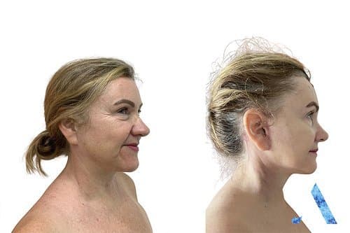 Before/After image 1