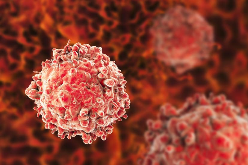 Leukemia Treatment Abroad - Best Countries, Clinics & Doctors