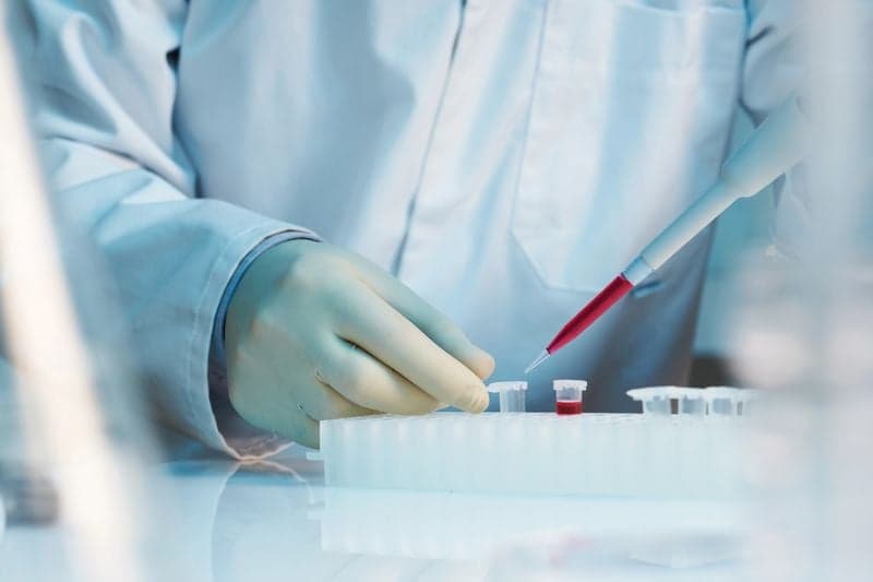 ALS Treatment in Turkey: Best Clinics and Costs