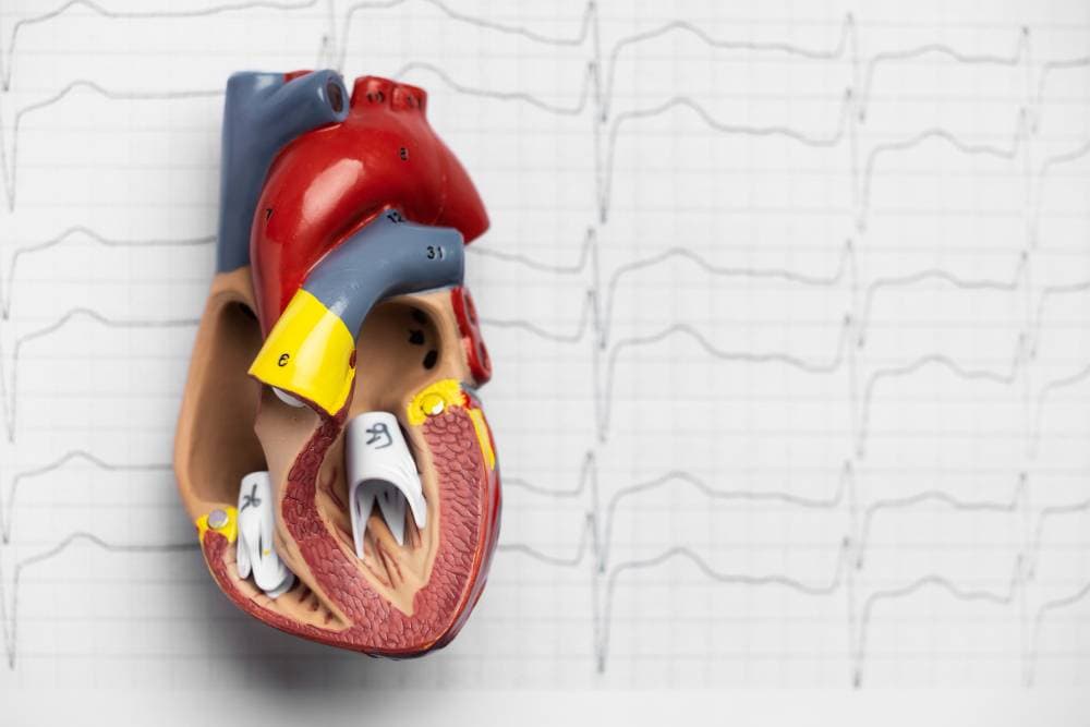 Best Countries for Atrial Fibrillation Treatment
