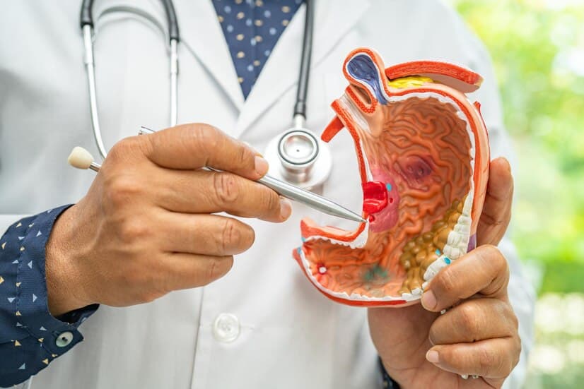 Stomach Cancer Treatment in Turkey