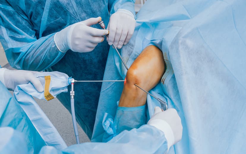 Arthroscopic Knee Surgery in Turkey - Costs and Best Clinics