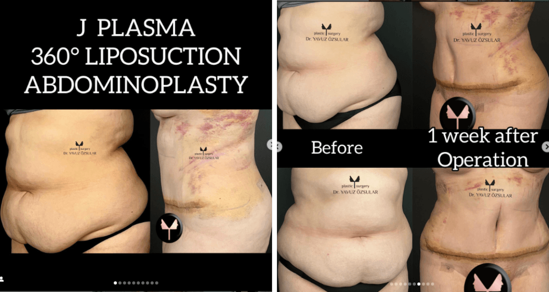 Before/After image 1