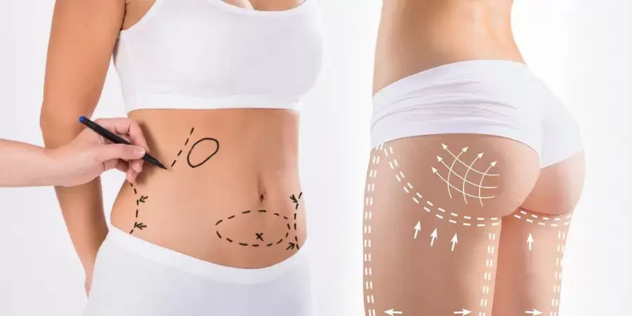 Can You Get a Tummy Tuck and a BBL at the Same Time?