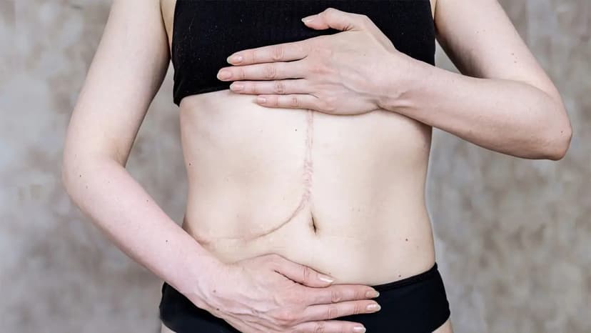 Best Countries in the World for Liver Transplant