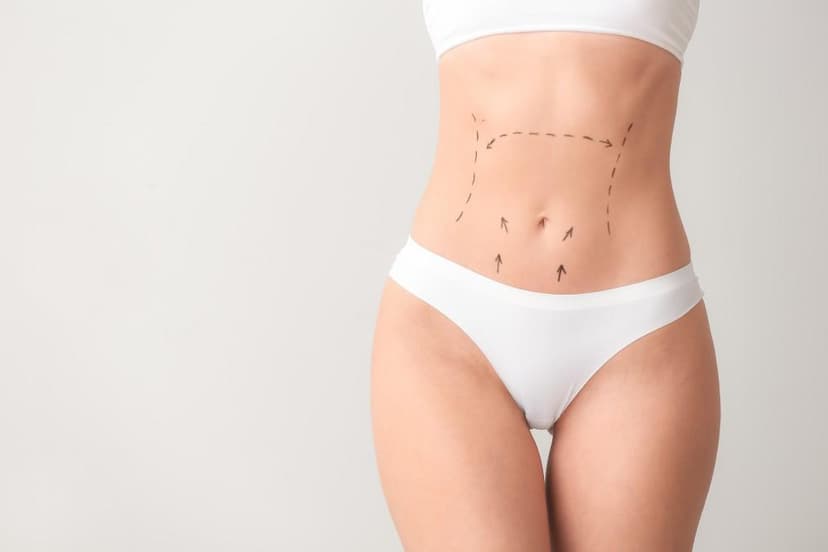 Liposuction in Turkey - Best Clinics, Costs and Packages