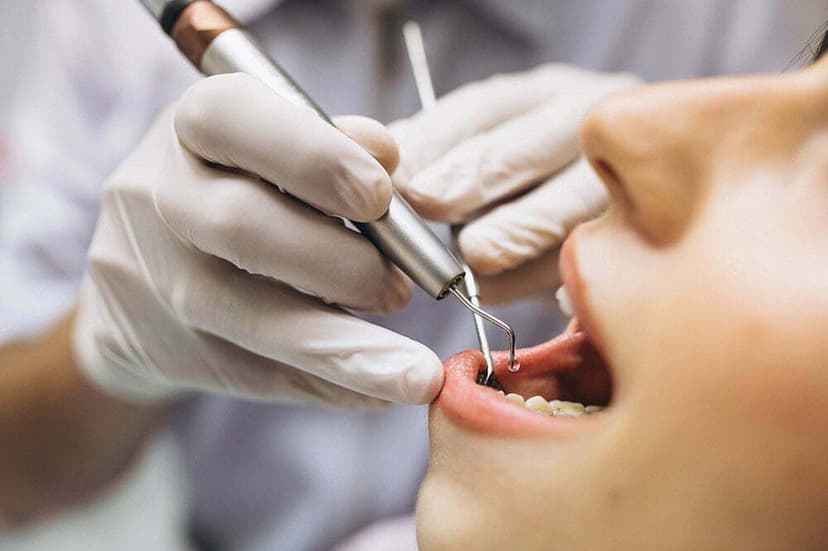 Dental Treatment in Turkey - Best Clinics, Costs & Packages
