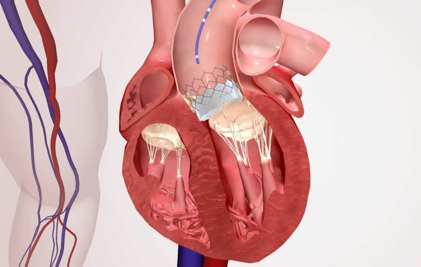 Heart Valve Replacement In Turkey (Costs, Clinics & Surgeons)