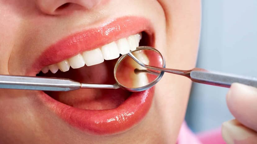 Why Dental Treatments Are Cheap In Turkey?