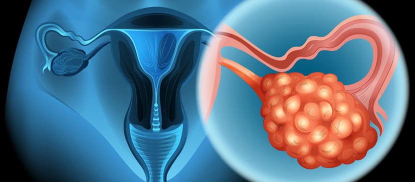Gynecologic Oncology in Turkey - Best Clinics & Oncologists