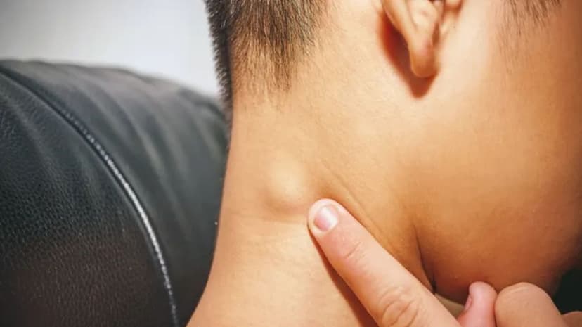 Lymphoma Treatment in Turkey - Best Clinics and Treatment