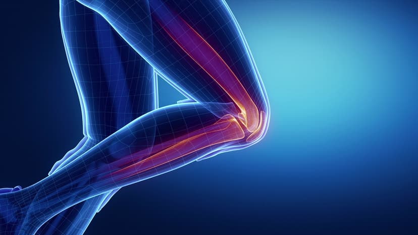 Stem Cell Therapy Meniscus Tear - Best Countries and Clinics