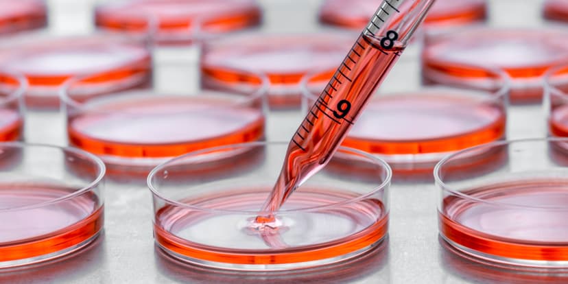 Best and Cheapest Countries for Stem Cell Therapy