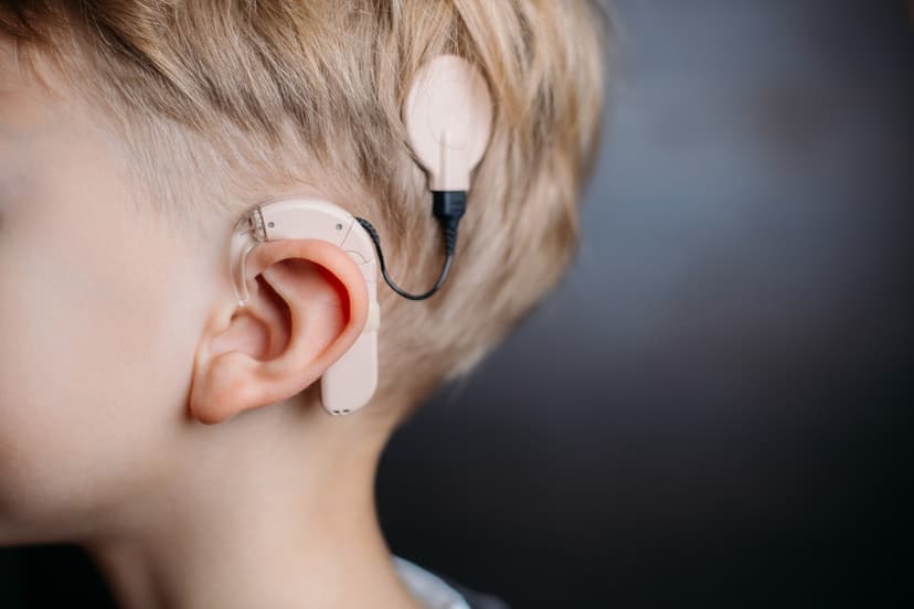 Cochlear Implant in Turkey - Clinics, Costs, Doctors (2026)
