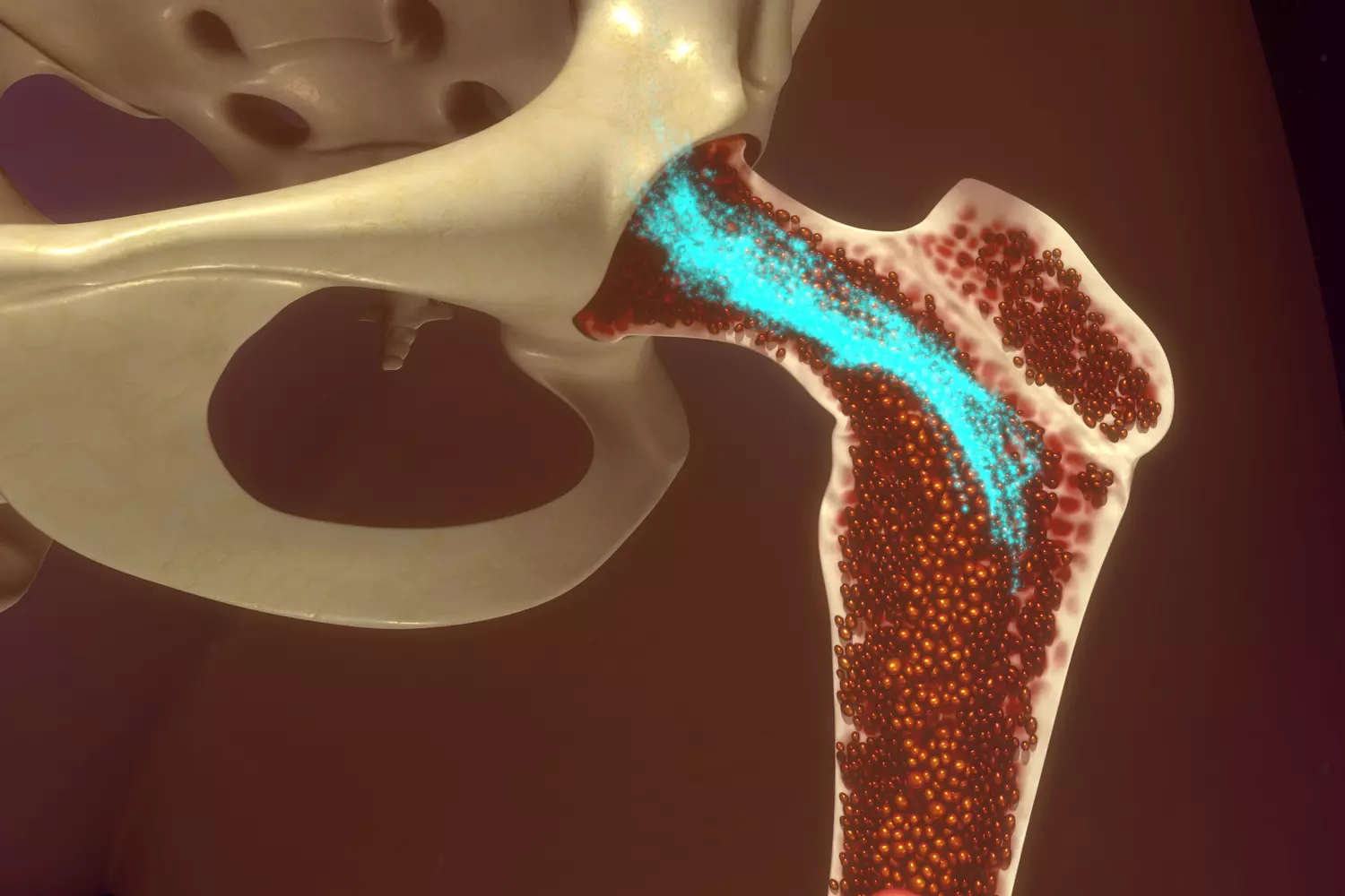 Bone Marrow Transplant Cost in Turkey